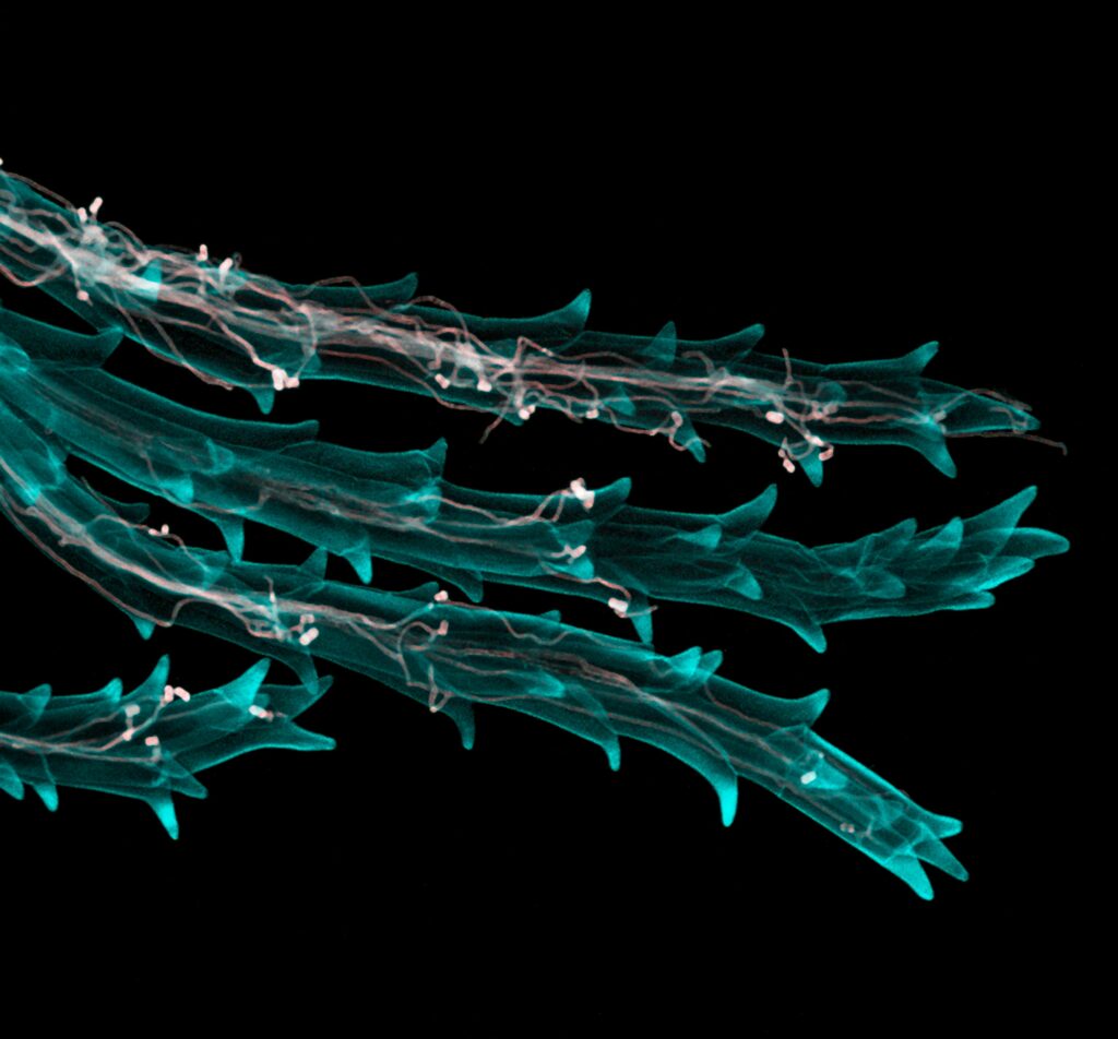 Tendrils of wheat are rendered in x-ray blue with wispy white pieces throughout, illustrating how ergot fungus infests wheat.